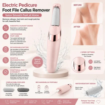 Rechargeable Electric Foot Callus Remover